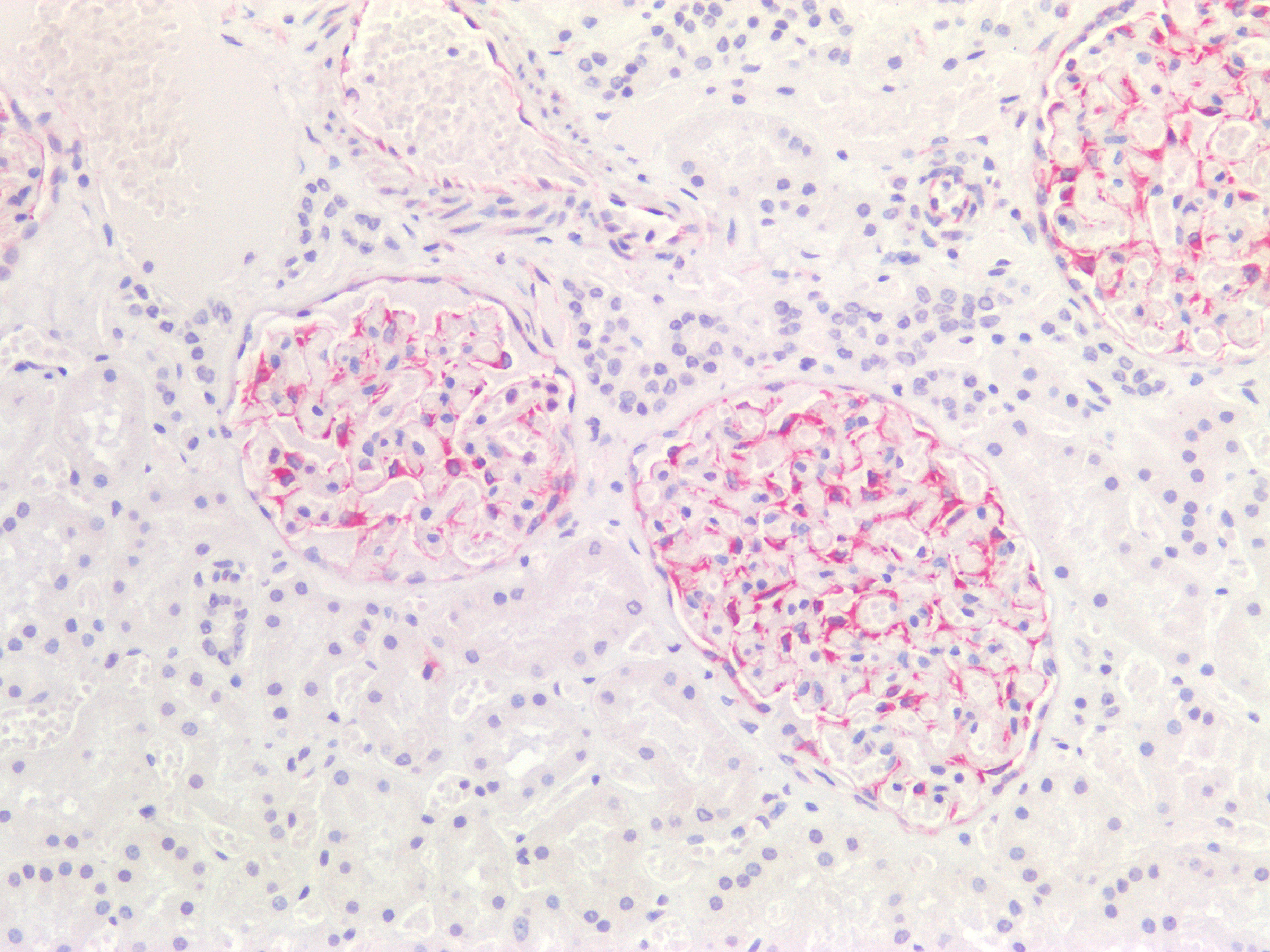 Figure 7. Immunostaining of human paraffin embedded tissue sections of human kidney with MUB1904P (diluted 1:200), showing the specific pattern of vimentin in the mesenchymal cell types, such as fibroblasts in the connective tissue, and podocytes.  As expected, no reactivity is seen in the epithelial cell compartment.